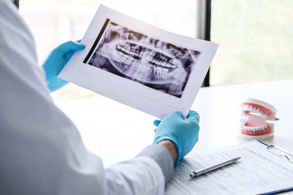 Image of male doctor or dentist holding and looking at dental x- Image of male doctor or dentist holding and looking at dental x-ray.