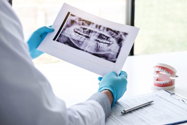 Image of male doctor or dentist holding and looking at dental x-ray.